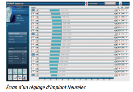 Écran d'un logiciel de réglage d'implant Neurelec
